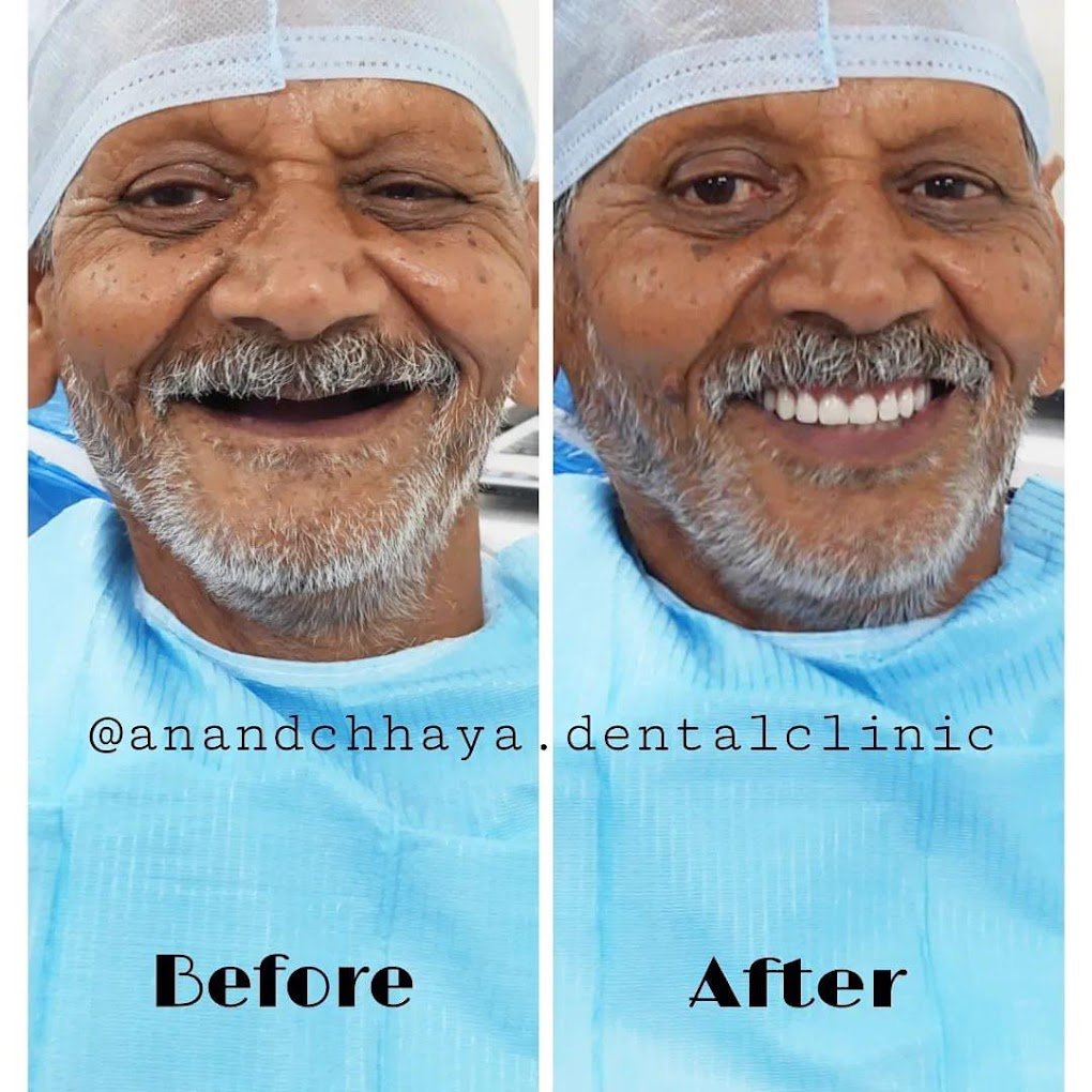 Anandchhaya patient