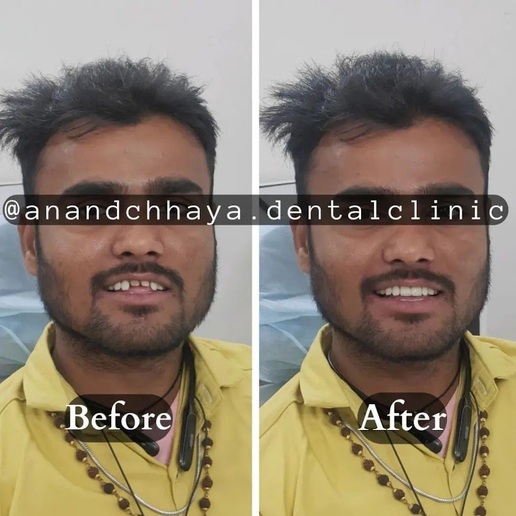 Anandchhaya patient
