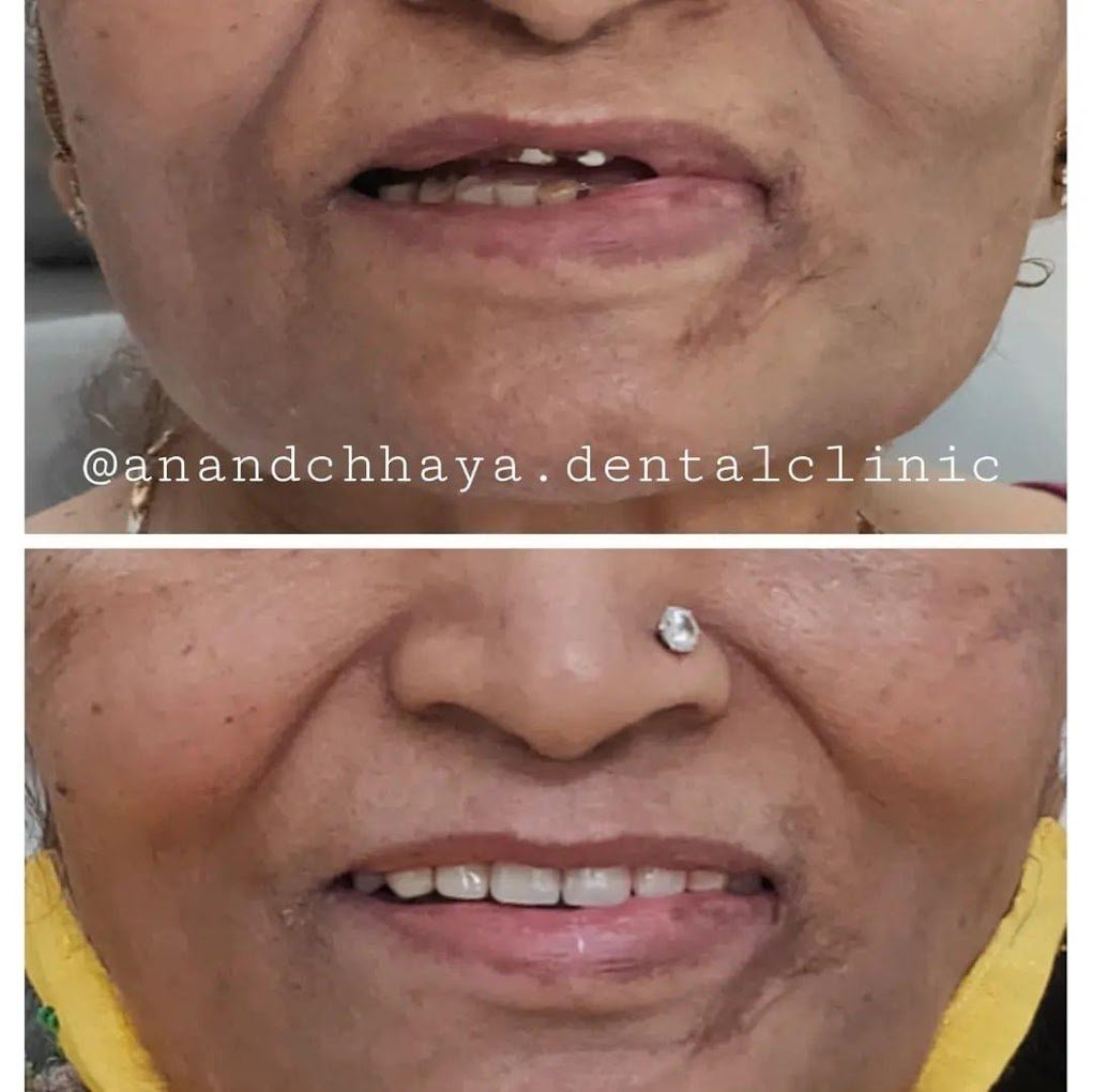 Anandchhaya patient