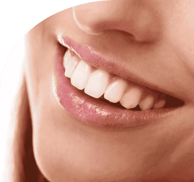 Smile Design service annandchhaya