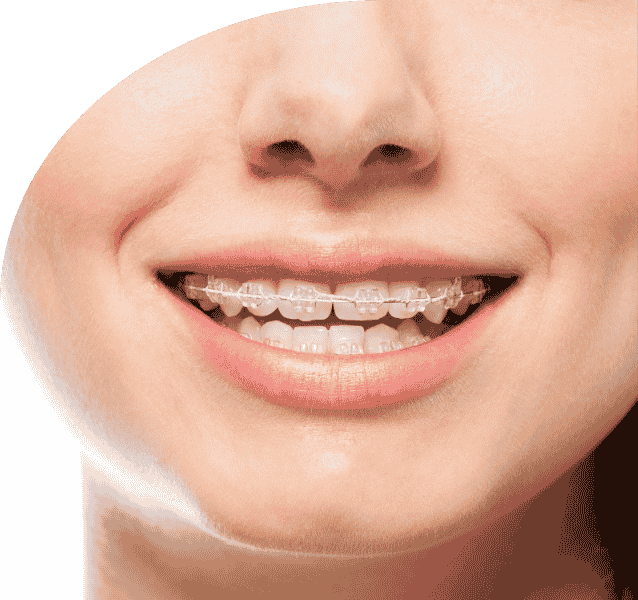 Orthodontic service annandchhaya