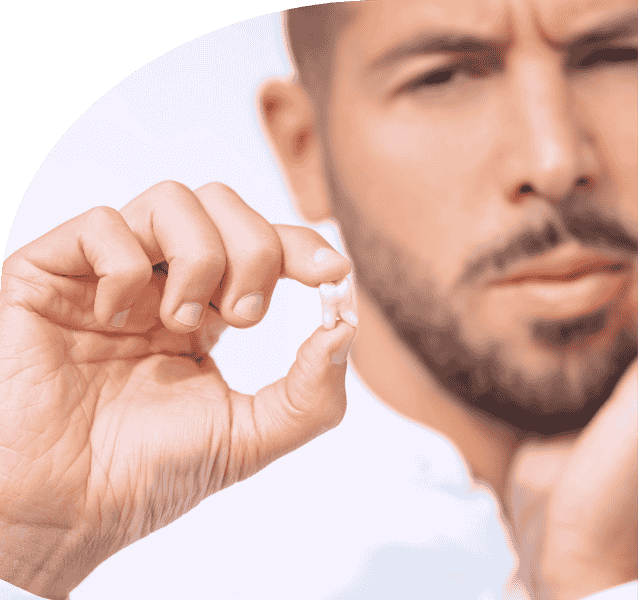 Wisdom Tooth Extraction service annandchhaya